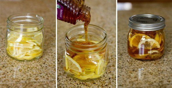Best Home Remedy For Sore Throat
