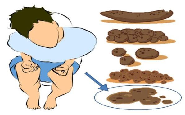 This is What You Need to Do to Get Rid of Constipation and Have a Perfect Poop
