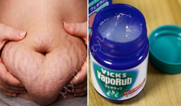 HOW TO USE VICKS VAPORUB TO GET RID OF ACCUMULATED BELLY FAT AND CELLULITE, ELIMINATE STRETCH MARKS AND HAVE FIRMER SKIN